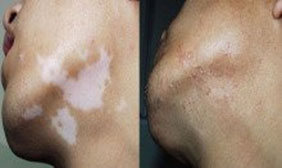 ���ݷ���Ƥ����ҽԺ