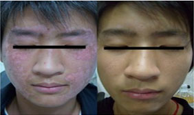 ���ݷ���Ƥ����ҽԺ