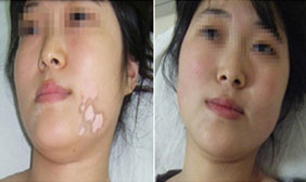 ���ݷ���Ƥ����ҽԺ