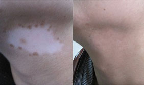 ���ݷ���Ƥ����ҽԺ