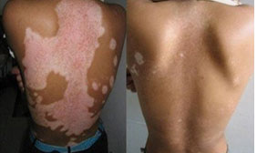 ���ݷ���Ƥ����ҽԺ