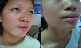 ���ݷ���Ƥ����ҽԺ