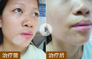 ���ݷ���Ƥ����ҽԺ