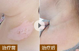 ���ݷ���Ƥ����ҽԺ