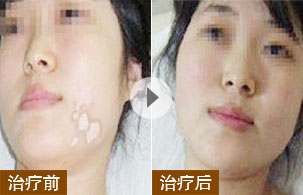 ���ݷ���Ƥ����ҽԺ