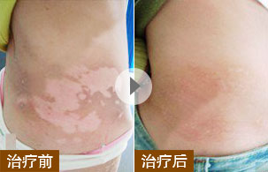 ���ݷ���Ƥ����ҽԺ