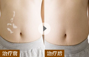 ���ݷ���Ƥ����ҽԺ