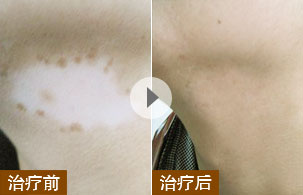 ���ݷ���Ƥ����ҽԺ