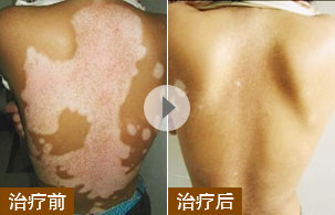 ���ݷ���Ƥ����ҽԺ