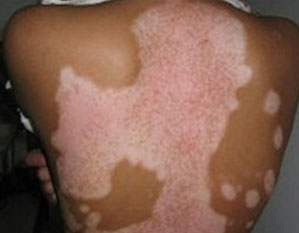 ���ݷ���Ƥ����ҽԺ