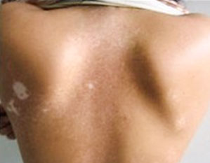 ���ݷ���Ƥ����ҽԺ