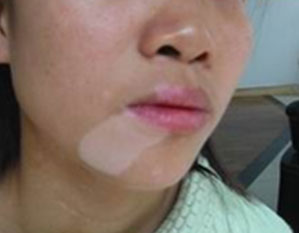 ���ݷ���Ƥ����ҽԺ