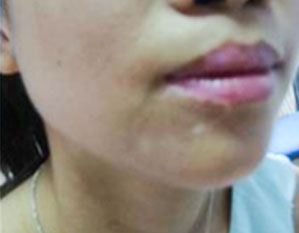 ���ݷ���Ƥ����ҽԺ