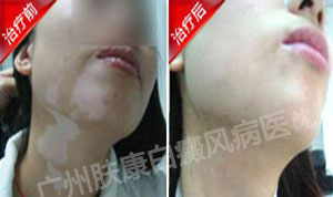 ���ݷ���Ƥ����ҽԺ