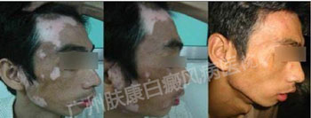 ���ݷ���Ƥ����ҽԺ