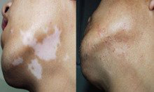 ���ݷ���Ƥ����ҽԺ