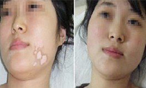 ���ݷ���Ƥ����ҽԺ